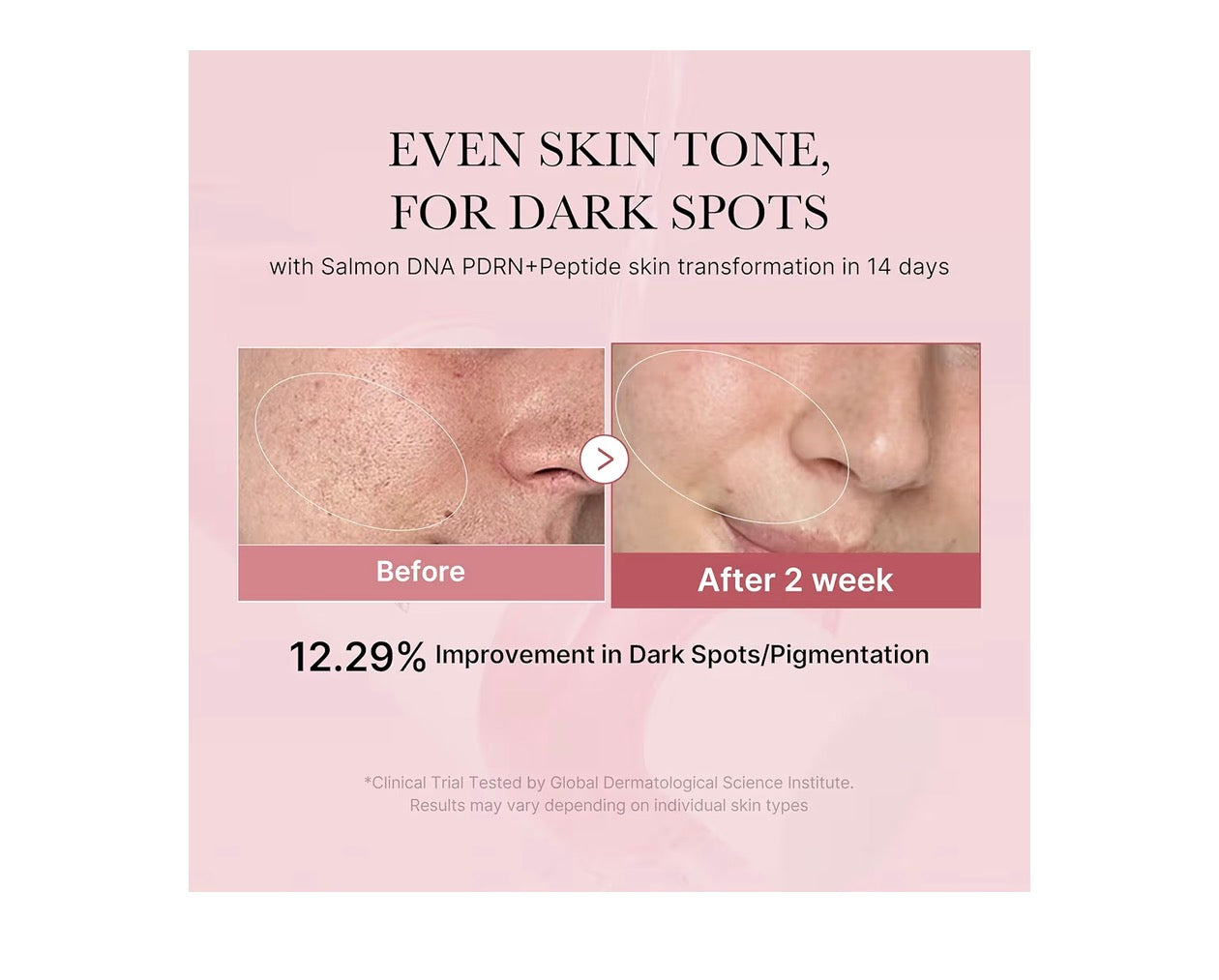 PDRN Pink Cica Soothing Toner