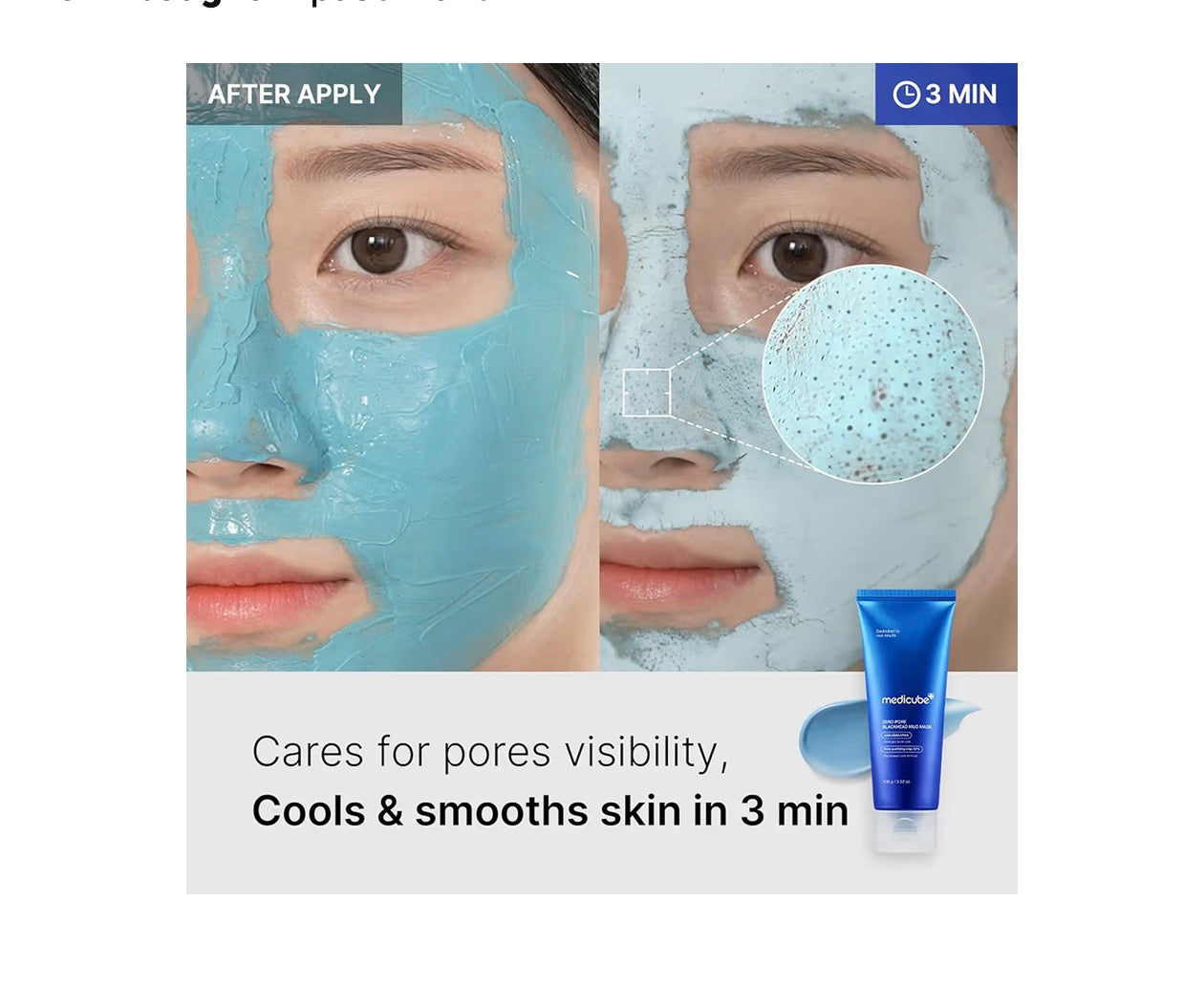 Medicube Zero Pore Blackhead Mud Facial Mask