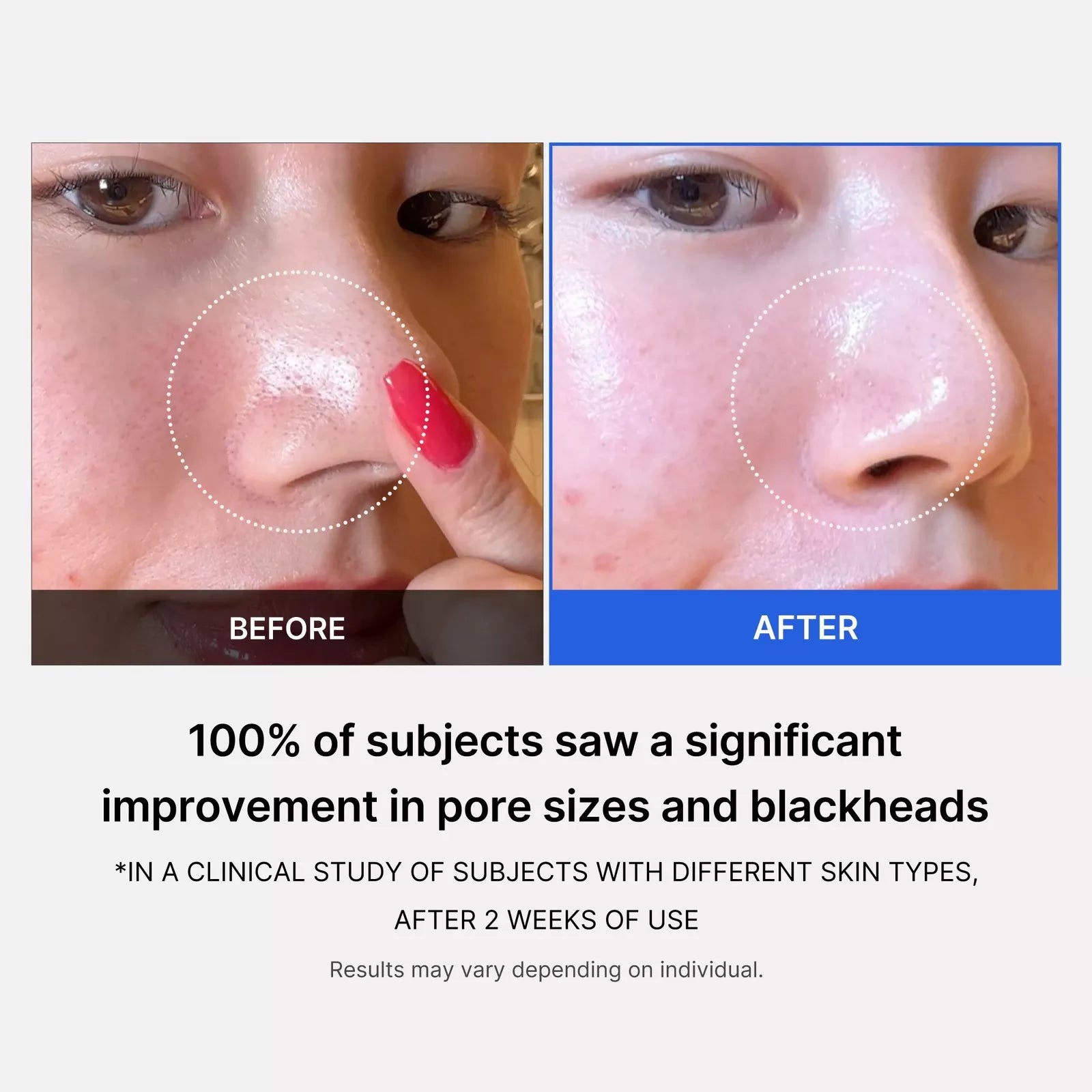 Medicube Zero Pore Pad